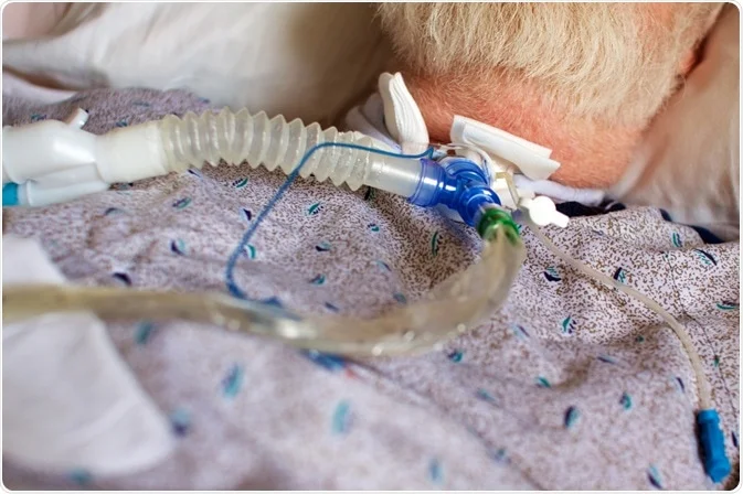 Tracheostomy Care in Bhopal